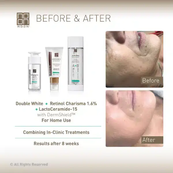 noon-kozmetika.nega-obraza